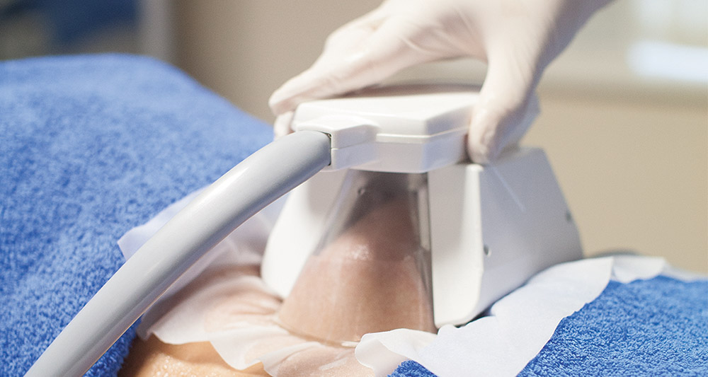 How Fat Freezing and HIFU Work Together? 2 Multiple Areas in One Session HIFU and Fat Freezing Stratford-upon-Avon