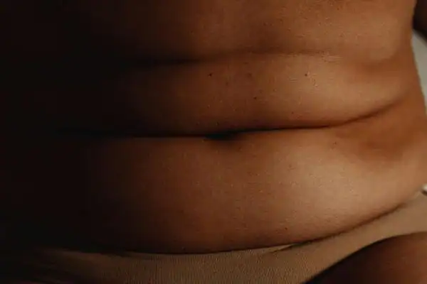 The Hidden Connection: How Stress Shapes Your Fitness and Body Composition 3 image of what stress can do on the stomach area and how Lipo 360 Stratford-upon-Avon can help to change your body shape.