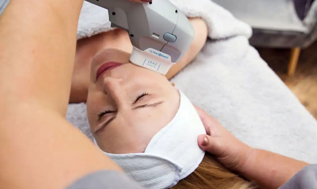 Discover the Perfect Duo: Morpheus8 and HIFU 1 Image of Morpheus8 And HIFU Stratford-upon-Avon combined treatment